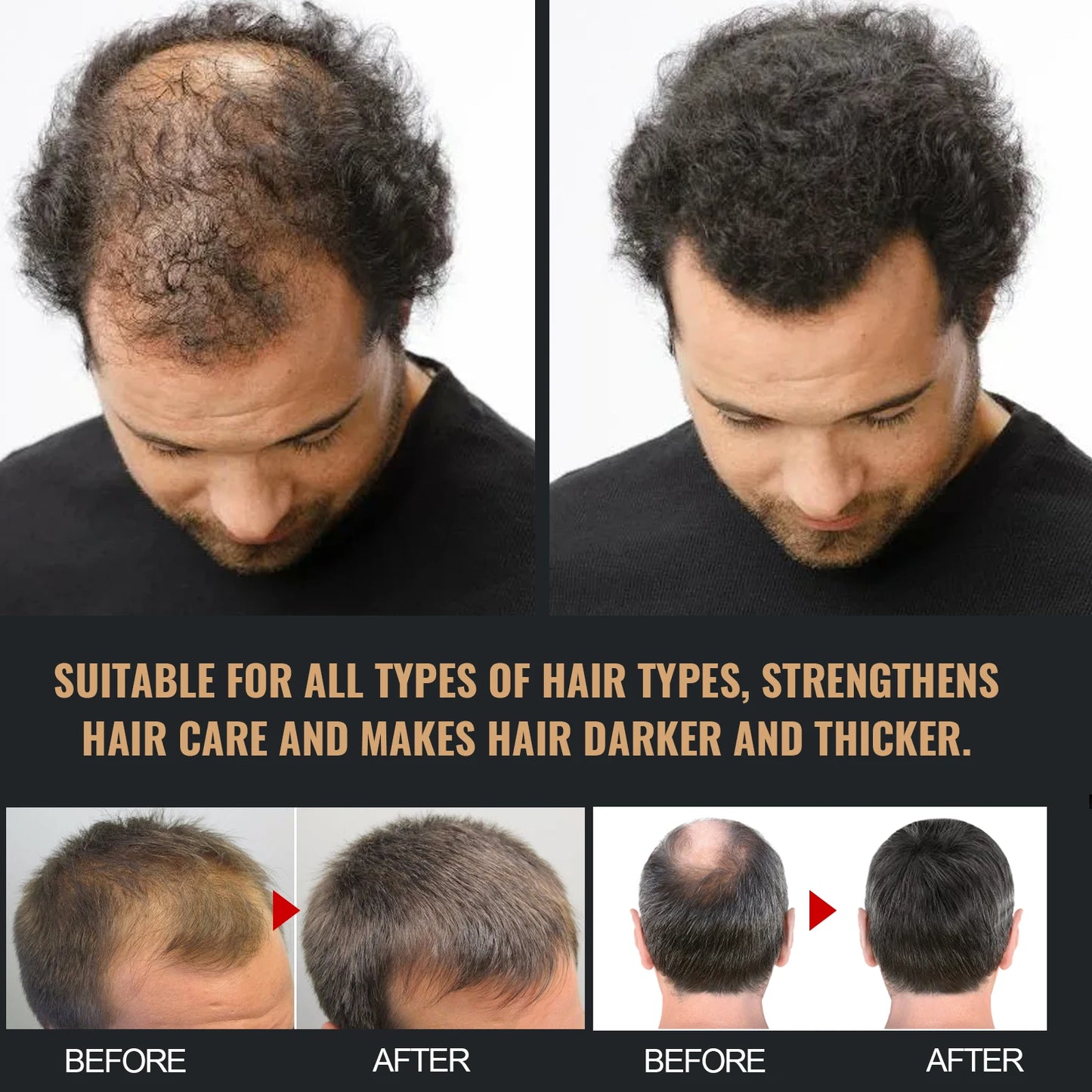 DermaScalp – Anti-Dandruff & Hair Strengthening Shampoo for Balanced Scalp