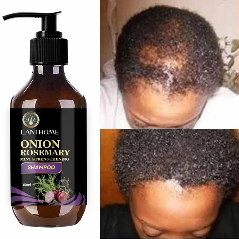 HerbalGrow – 100ML Rosemary & Onion Shampoo for Fast Hair Growth & Anti-Hair Los
