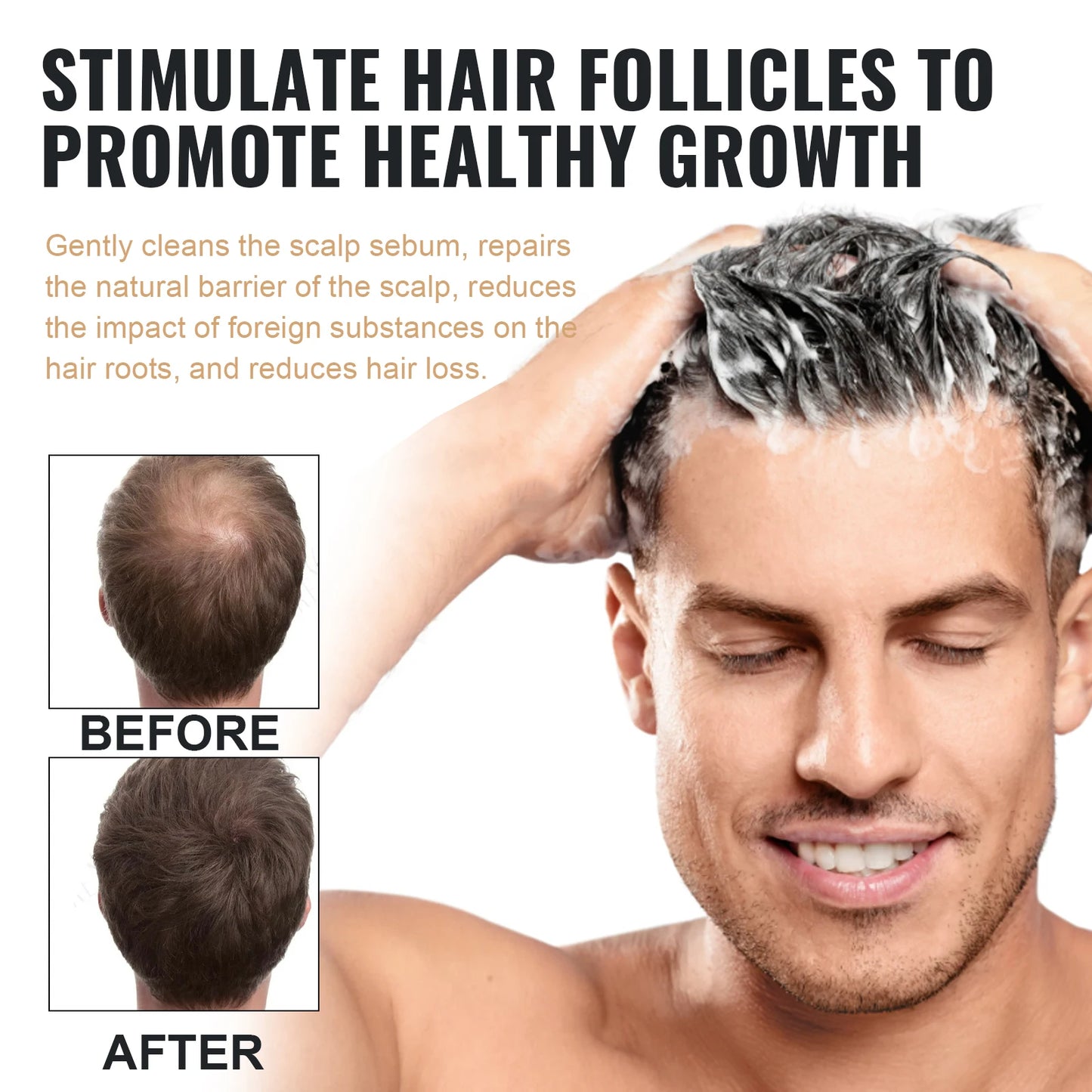 DermaScalp – Anti-Dandruff & Hair Strengthening Shampoo for Balanced Scalp