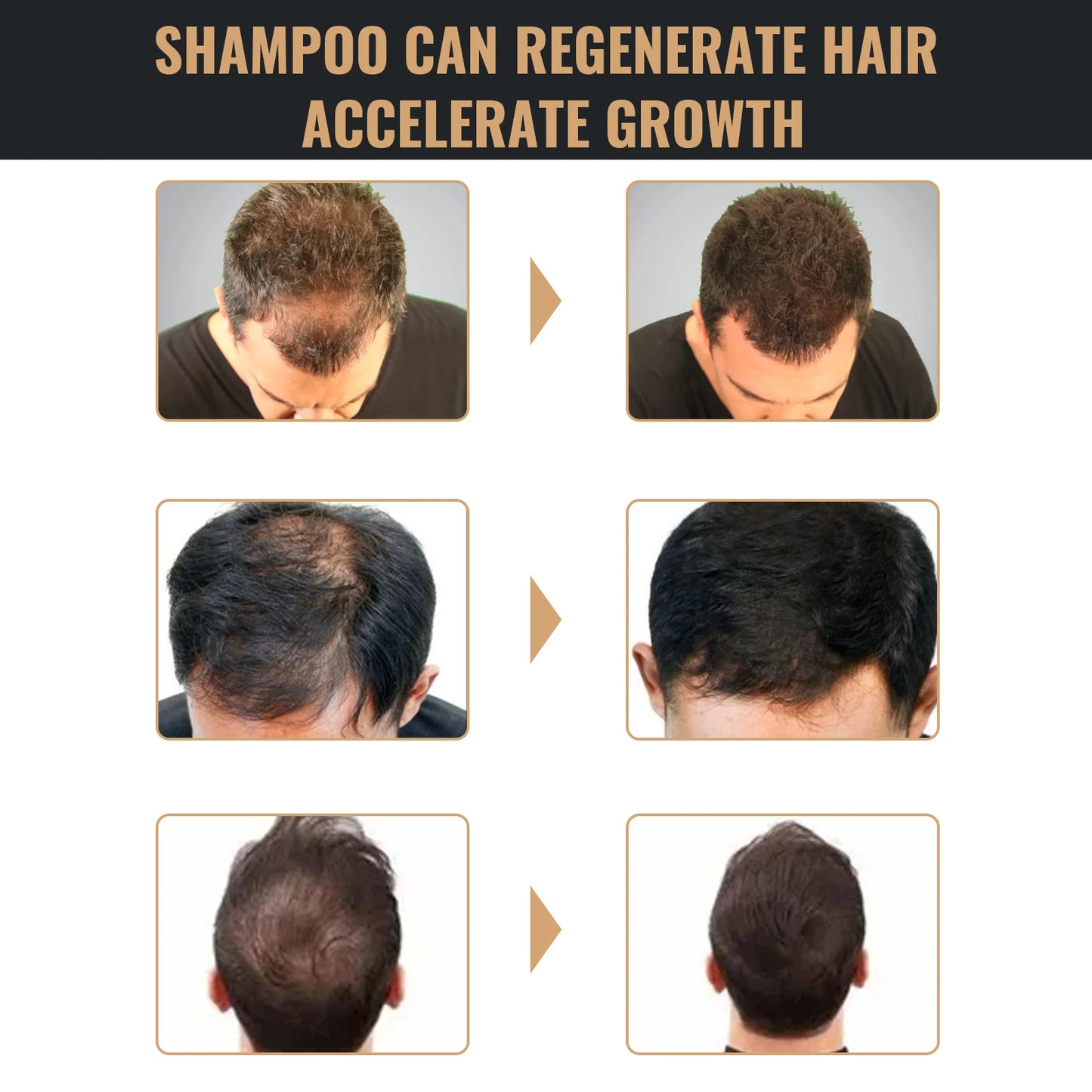DermaScalp – Anti-Dandruff & Hair Strengthening Shampoo for Balanced Scalp