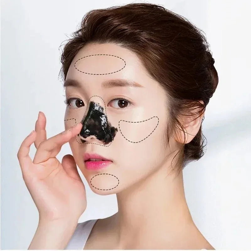 LANBENA ClearGlow – Blackhead Removal & Pore Shrinking Deep Clean Mask