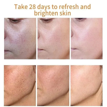 LumiPure Radiance – Dark Spot Correcting Face Cream with Niacinamide & Vitamin E