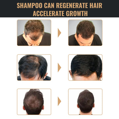 DermaScalp – Anti-Dandruff & Hair Strengthening Shampoo for Balanced Scalp