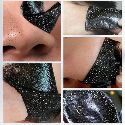 LANBENA ClearGlow – Blackhead Removal & Pore Shrinking Deep Clean Mask