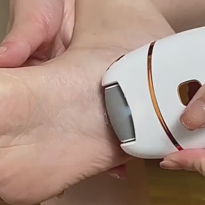 Rechargeable Electric Foot File with 3 Replaceable Grinding Heads